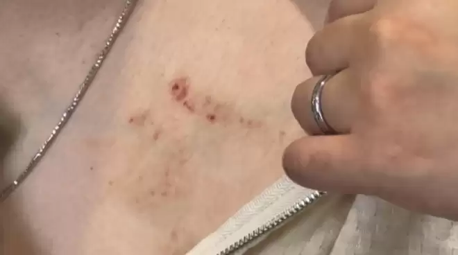 60秒命悬一线! 加拿大亚裔夫妻"卖闲置"被盯上 歹徒入室暴力袭击