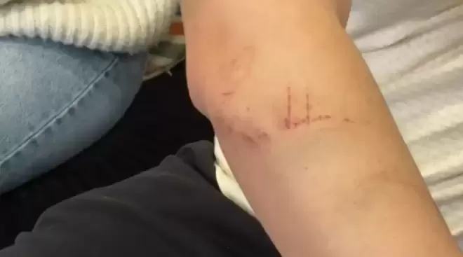 60秒命悬一线! 加拿大亚裔夫妻"卖闲置"被盯上 歹徒入室暴力袭击