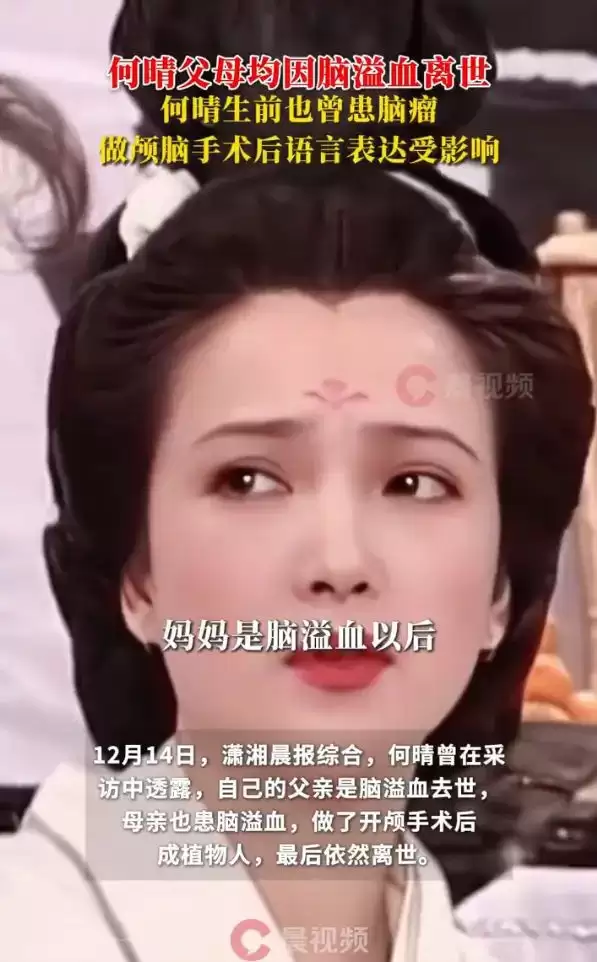 61岁何晴因患脑瘤不治身亡！其父母均因脑溢血离世，曾演《三国演义》小乔