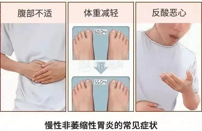 这6种病听起来很吓人,但基本不用治,别再花冤枉钱