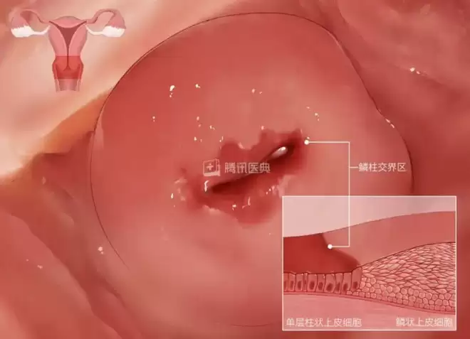 这6种病听起来很吓人,但基本不用治,别再花冤枉钱