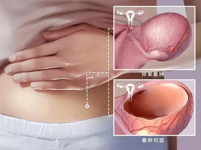 这6种病听起来很吓人,但基本不用治,别再花冤枉钱