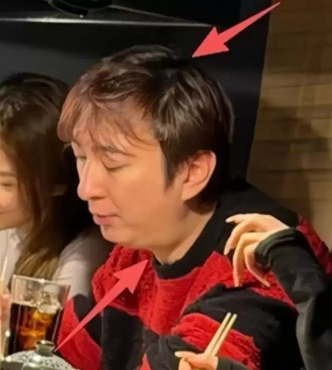 37岁王思聪面相变了,下巴后缩秃头有姨味,带五个女伴憔悴