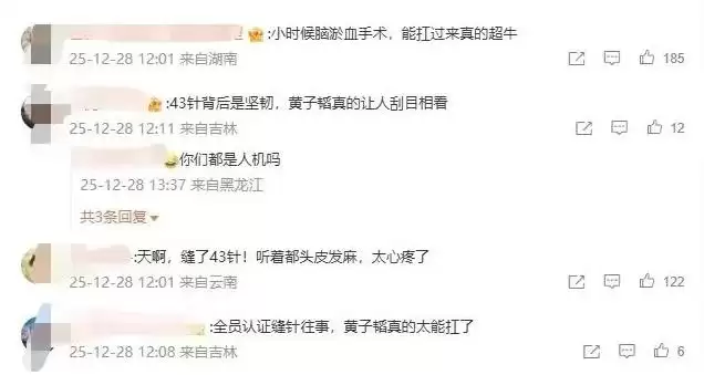 黄子韬因脑淤血开颅手术缝了43针 本人回应