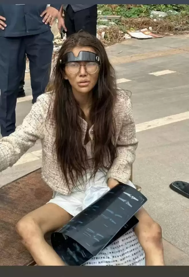 女网红被男友骗至柬埔寨 如今双腿骨折流浪街头