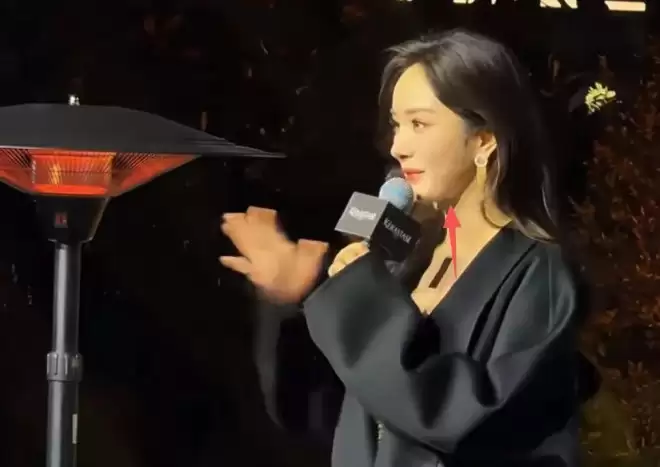 杨幂最新露面脸部浮肿僵硬，疑似医美没恢复