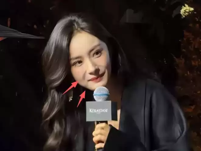 杨幂最新露面脸部浮肿僵硬，疑似医美没恢复