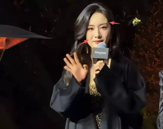 杨幂最新露面脸部浮肿僵硬，疑似医美没恢复