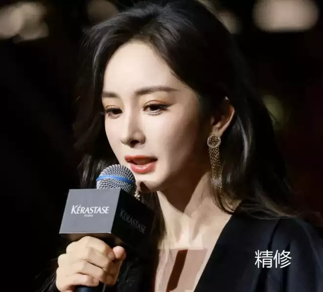 杨幂最新露面脸部浮肿僵硬，疑似医美没恢复