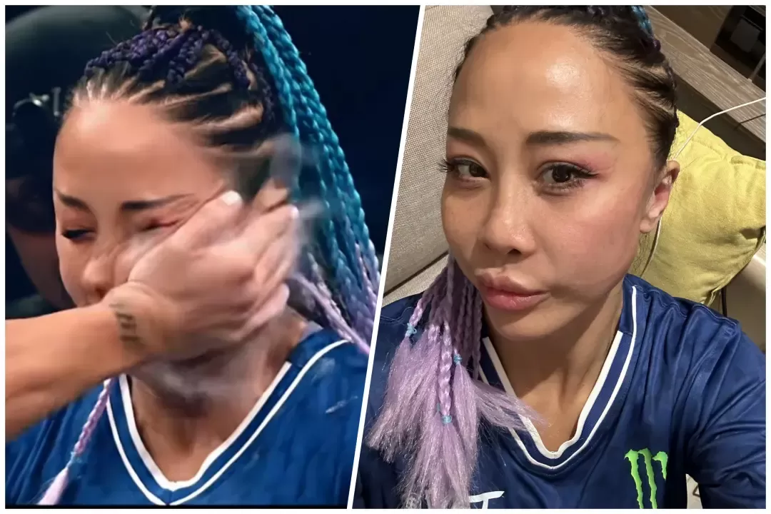 “世界扇耳光大赛”唯一中国女选手：我不疼