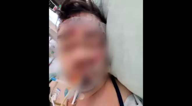 加拿大27岁男子戴耳机过马路, 被公交车撞残! 父亲表扬司机!