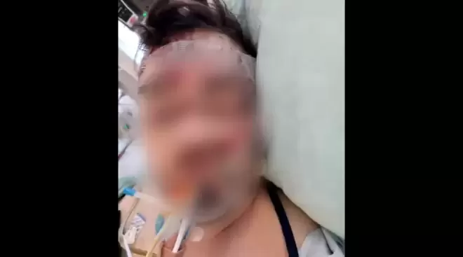 加拿大27岁男子戴耳机过马路, 被公交车撞残! 父亲表扬司机!