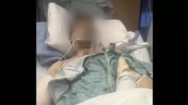 加拿大27岁男子戴耳机过马路, 被公交车撞残! 父亲表扬司机!