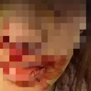 律师：金晨不算逃逸，助理涉嫌违法！喜之郎已悄悄恢复删除的代言内容