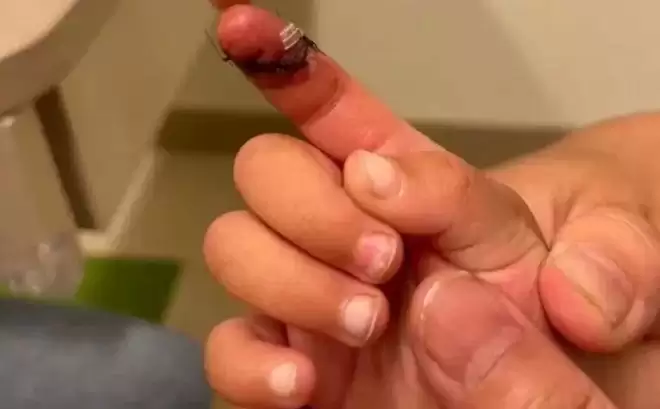 郑爽抱着孩子头发都白了！一家人和张恒当街吵架