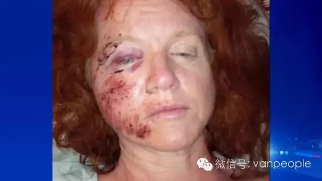 加拿大有一种凶残的生物，叫做加拿大鹅，绝对是奇葩中的战斗鹅