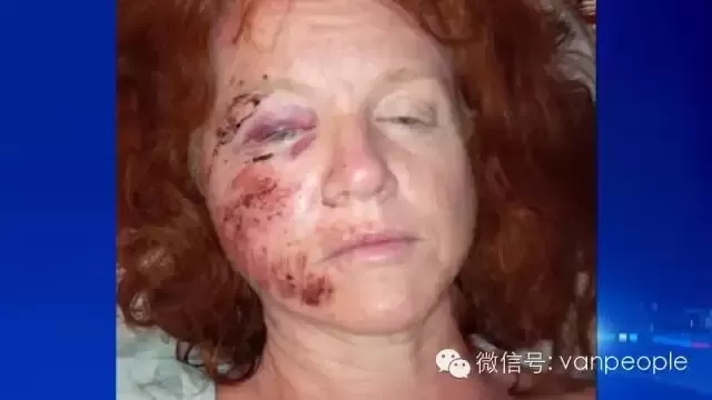 加拿大有一种凶残的生物，叫做加拿大鹅，绝对是奇葩中的战斗鹅