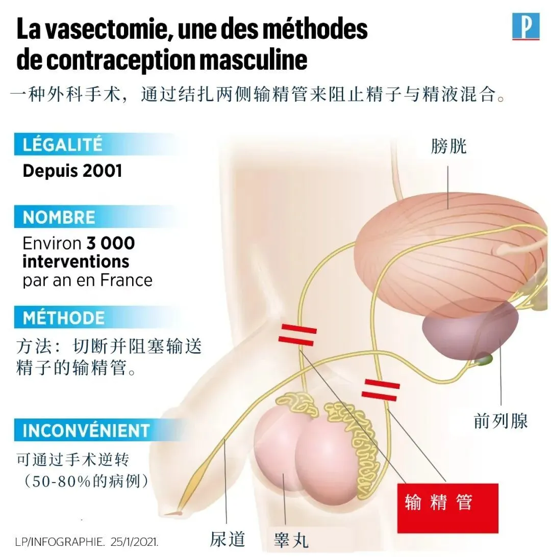 美国：一年50万男人结扎，这个月特别多