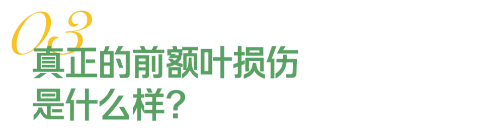 “我的前额叶罢工了” 年轻人争相确诊“脑残网红病”