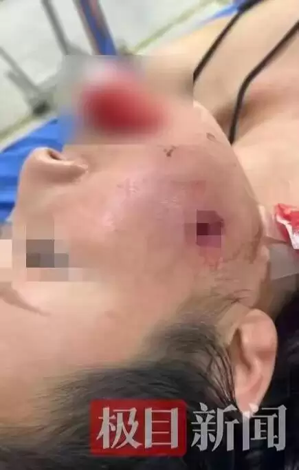 中国游客在泰国中弹，女儿：母亲住院只能吃流食