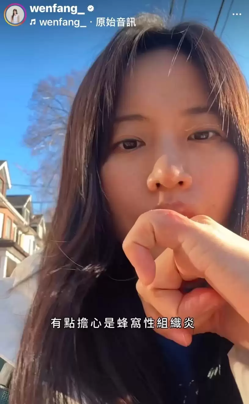 【有片】36岁女艺人加国旅游急就医 &nbsp;叹医药费贵得“不敢看”掀论战