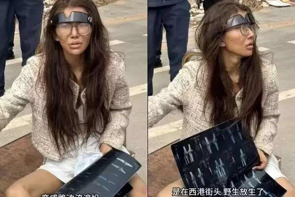 女网红断腿街头流浪 直播揭卖猪仔内幕突遭封禁