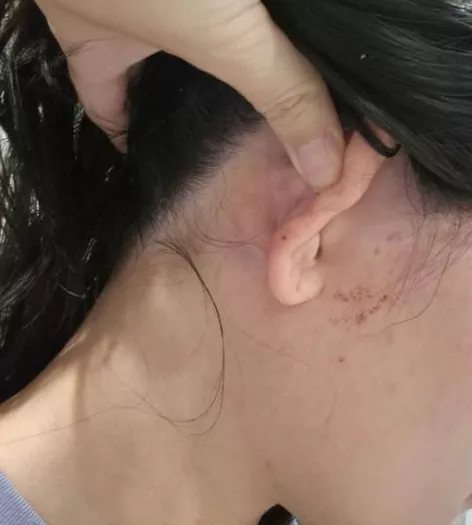 27岁中国女澳洲遭辱骂狂殴 满面鲜血 需辞职休养