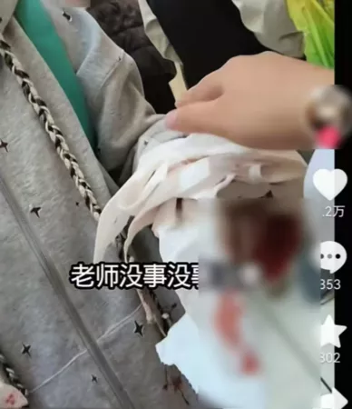 商场动漫展突降“玻璃碎片雨” 多人带血狂奔 有人失明…