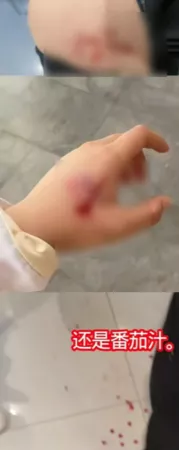 商场动漫展突降“玻璃碎片雨” 多人带血狂奔 有人失明…