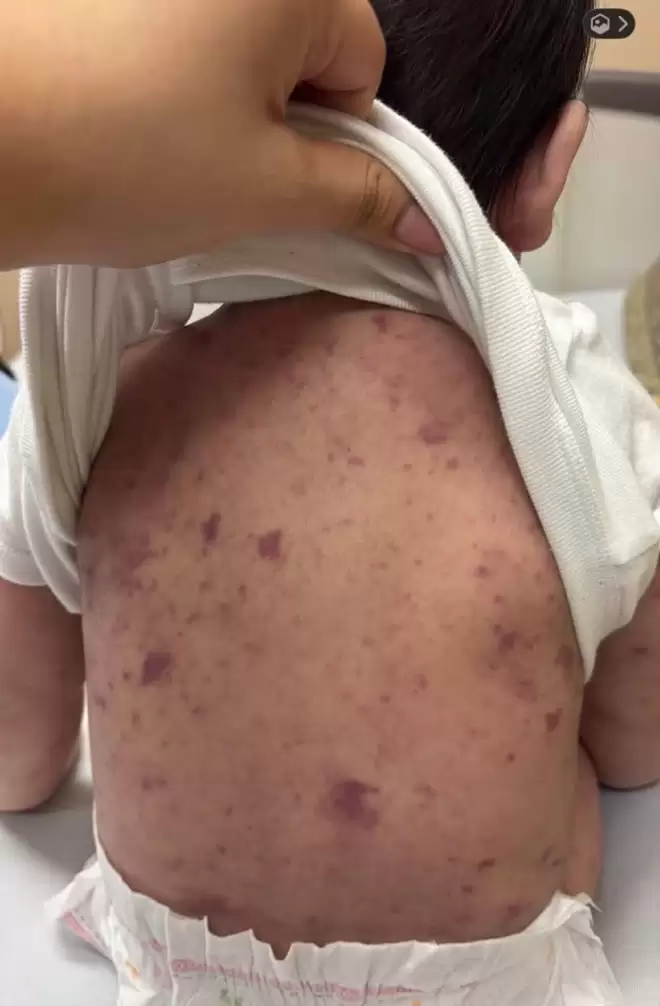 安省11个月男婴苦等医生5小时后身亡！母亲崩溃：他本可活下来
