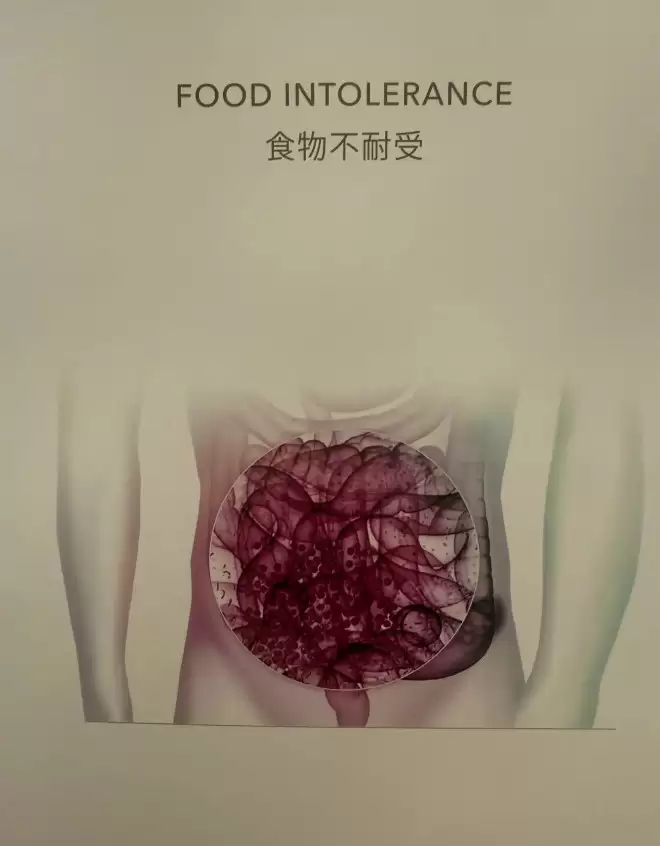 毛晓彤回应去医美诊所：从小爱吃面食，查出面粉不耐受可怎么办