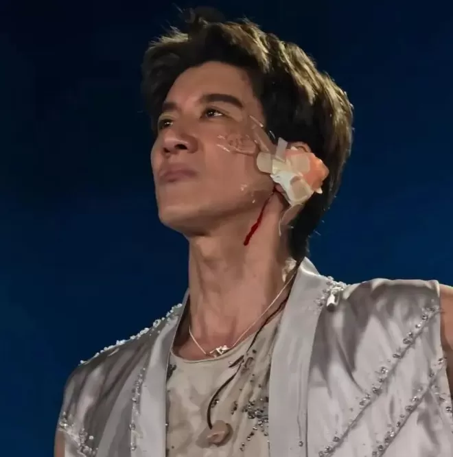 王力宏治疗摔伤细节曝光,去的医美科找的顶级专家
