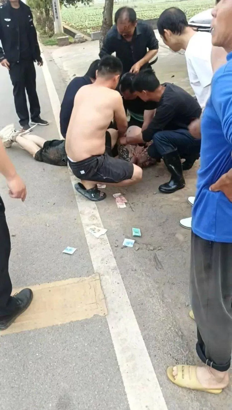 湖南男当街打女人遭路人制止 竟“咬掉鼻子”还吞下肚