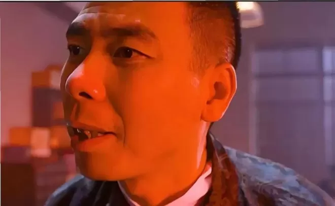 冯小刚终被曝脑袋全是斑块,养女徐朵脸肿原因藏不住了