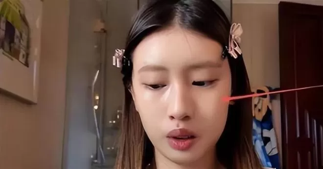 冯小刚终被曝脑袋全是斑块,养女徐朵脸肿原因藏不住了