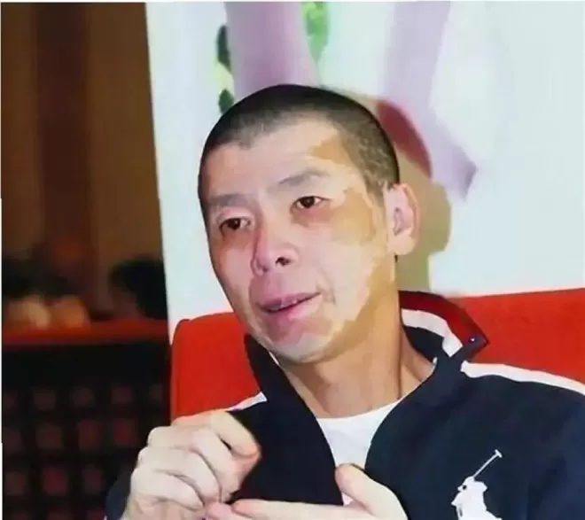 冯小刚终被曝脑袋全是斑块,养女徐朵脸肿原因藏不住了