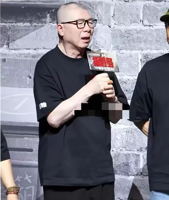 冯小刚终被曝脑袋全是斑块,养女徐朵脸肿原因藏不住了