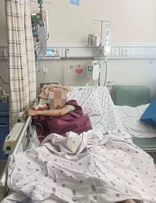 女孩从18楼坠落，经医院抢救奇迹生还