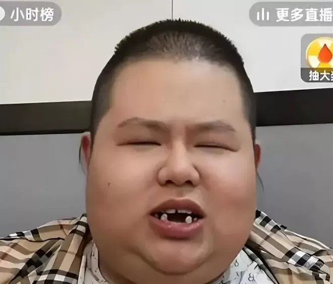 曾力压胡歌夺冠，如今343斤靠吃年入百万、女友不断