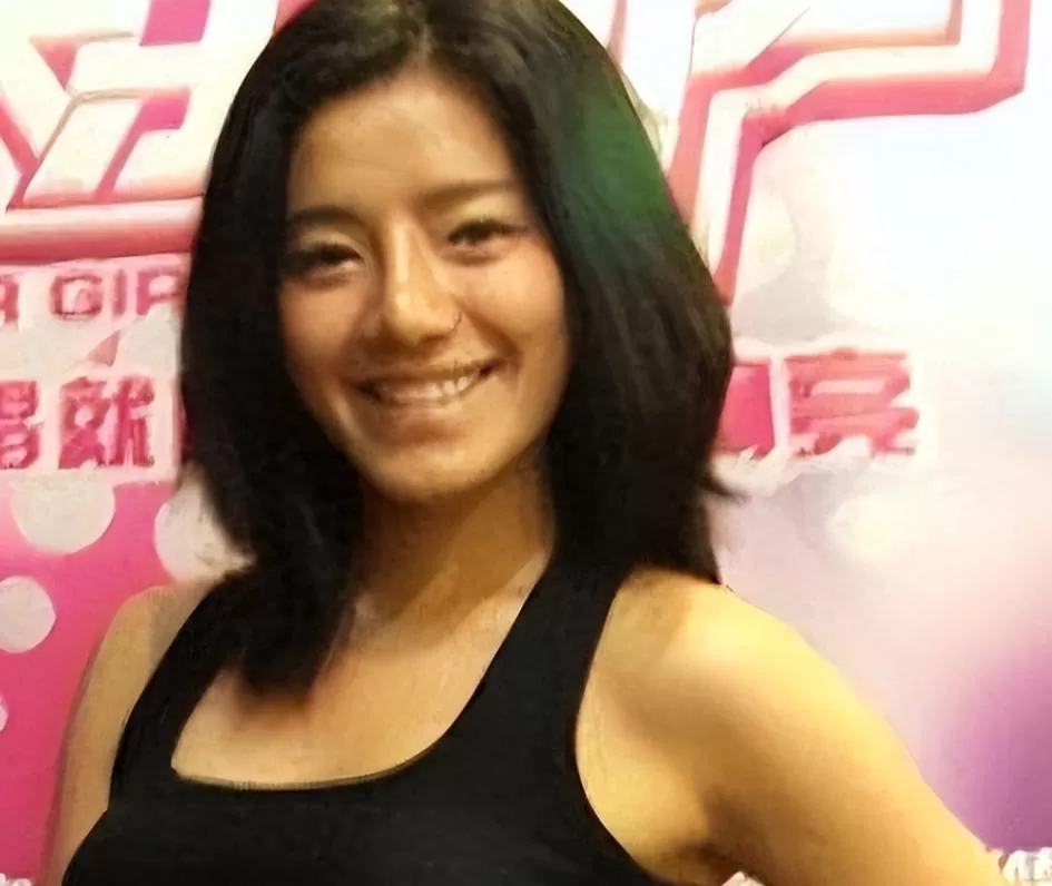 超女冠军江映蓉：过度医美后像"怪物"，全身只剩下眼珠是自己的