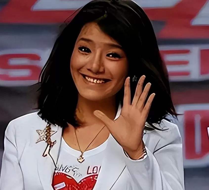 超女冠军江映蓉：过度医美后像"怪物"，全身只剩下眼珠是自己的