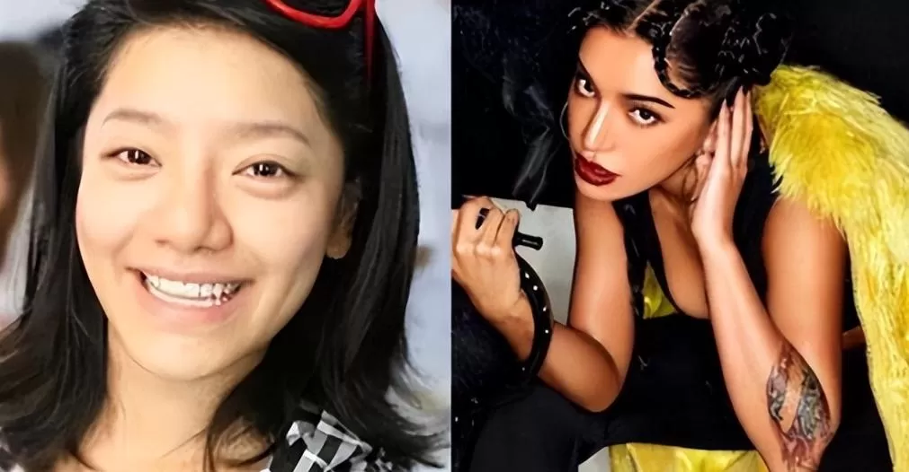 超女冠军江映蓉：过度医美后像"怪物"，全身只剩下眼珠是自己的