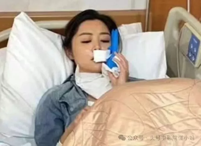 41岁影后刚熬出头就毁容！嘴缝50针不喊疼