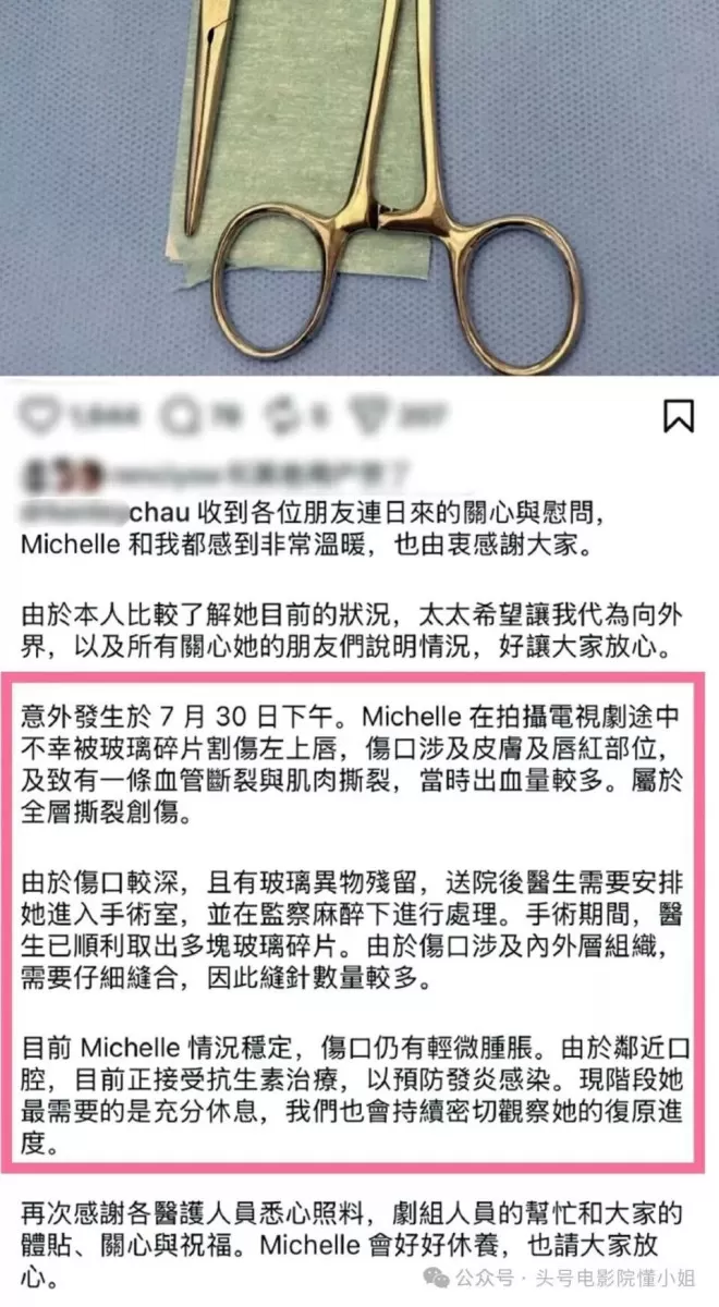 41岁影后刚熬出头就毁容！嘴缝50针不喊疼