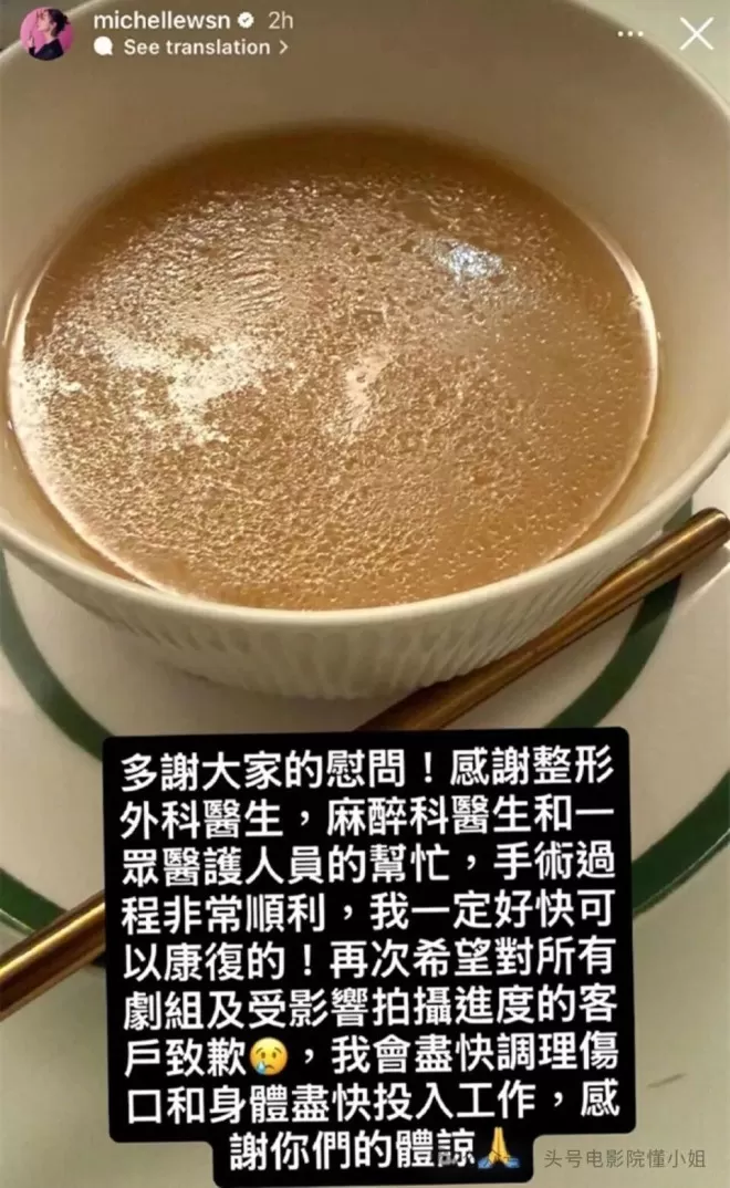 41岁影后刚熬出头就毁容！嘴缝50针不喊疼