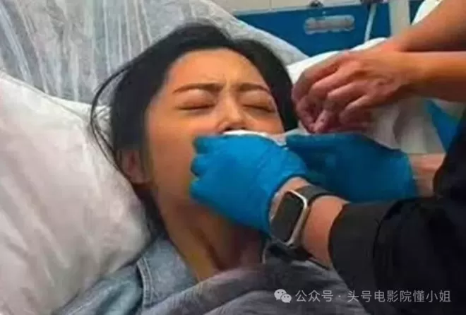 41岁影后刚熬出头就毁容！嘴缝50针不喊疼
