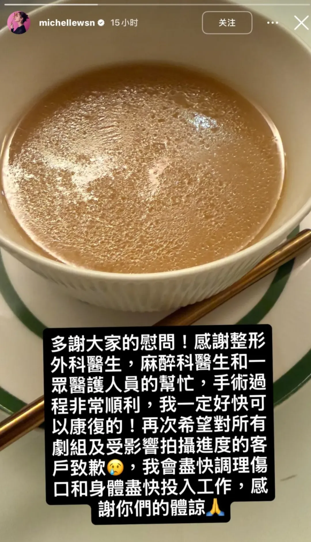 惊险! 华人女星拍戏时出意外 脸部缝50多针! 重伤后拿下影后 领奖不敢大笑!
