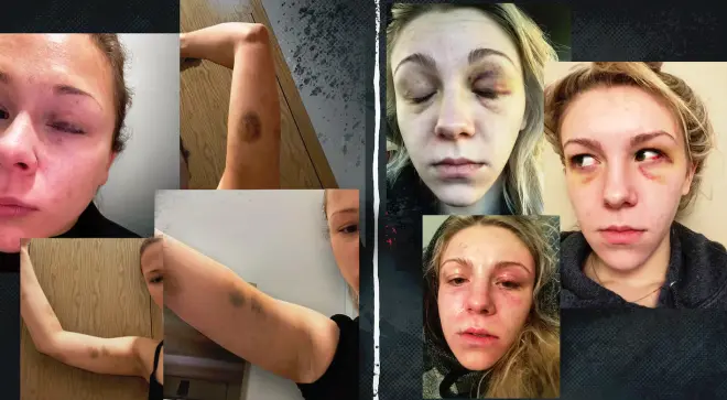 恐怖! 加拿大男子涉嫌打死女友! 前女友曝照: 这种人是不会变的!