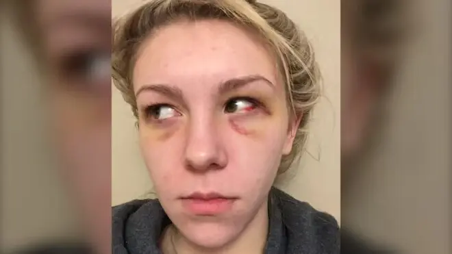 恐怖! 加拿大男子涉嫌打死女友! 前女友曝照: 这种人是不会变的!