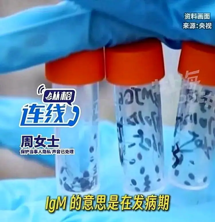 复旦女硕士游义被蜱虫咬染重症 严重时生活不能自理 家属全网求助
